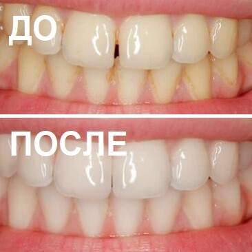 Имплантация в Подольске